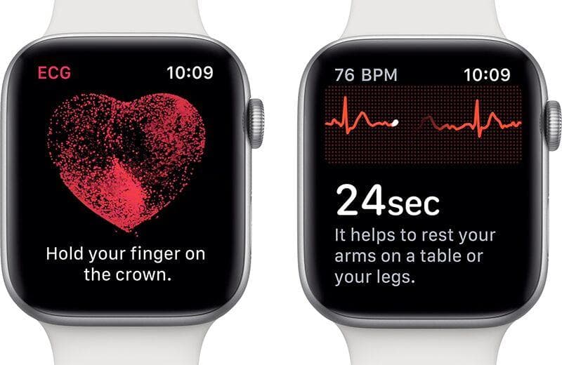 Apple Watch EKG