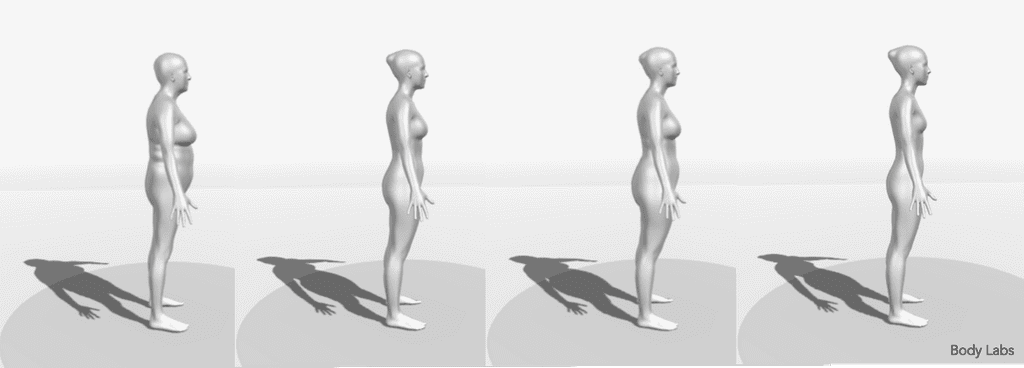 BMI body shape